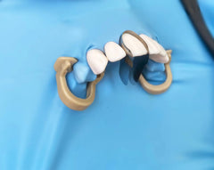 RWBATT 30Pcs/Box Anterior Matrix Bands, Dental Metal Curvature Matrix Bands for Proximal Anterior Restoration Thickness 30μm