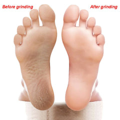 Double-Sided Foot File, 6pcs Foot Rasp Files Disposable Foot Rasp Manicure File Callus Hard Skin Remover