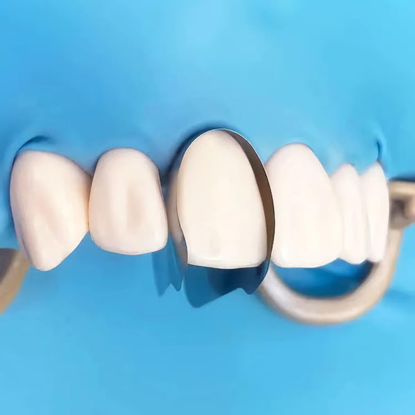 RWBATT 30Pcs/Box Anterior Matrix Bands, Dental Metal Curvature Matrix Bands for Proximal Anterior Restoration Thickness 30μm