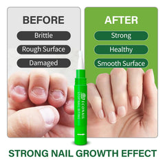 Econail Stop Nail biting Kids Pen (Ultra Bitter), Nail Biting treatment for kids, thumb sucking deterrent, Anti finger sucking 7ml,Natural Nail Care Pen