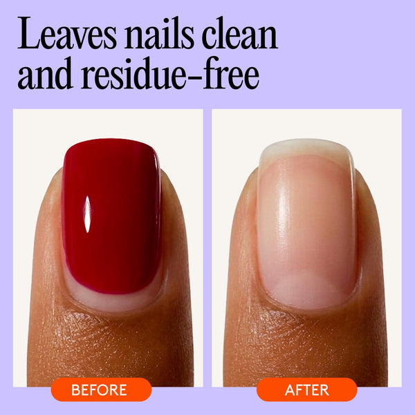 Mylee 100% Pure Acetone (300ml) - Gel Nail Polish Remover – Maximum Strength Professional Soak-Off for UV/LED, Acrylics, Nail Tips & Glue - Made in the UK