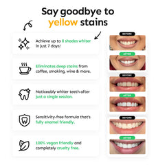 Whites Beaconsfield Teeth Whitening Strips, 28 Strips (14-Day Treatment) – Non-Peroxide Formula, Enamel-Safe, Brighten Teeth Fast, Removes Coffee, Wine, Smoke Stains, Safe for Sensitive Teeth