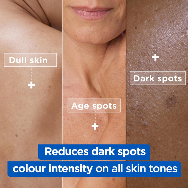 Mixa Cream, Niacinamide Bright Moisturizing Anti-Dark Spot Cream, Body Care Dark Spot Corrector for Uneven Tone, with 9% Niacinamide, Shea Butter & Vitamin C, 400ml