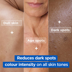 Mixa Cream, Niacinamide Bright Moisturizing Anti-Dark Spot Cream, Body Care Dark Spot Corrector for Uneven Tone, with 9% Niacinamide, Shea Butter & Vitamin C, 400ml