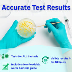 Evviva Sciences Water Bacteria Test Kit – 10 Tests for Total Bacteria, coliforms & E. coli. Lab-Ready agar Plates for Well, tap, Pool, & City Water. Fast DIY Results + Optional lab Report.